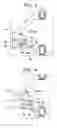Fig. 04 - Piezoresistive pressure sensor