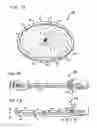 Fig. 07 - SEMICONDUCTOR WAFER AND METHOD FOR PRODUCING SAME