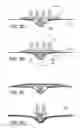 Fig. 04 - Touch fastener products