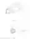 Fig. 08 - APICAL ACCESS AND CONTROL DEVICES