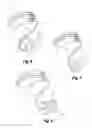 Fig. 05 - Hearing aid earpiece and a method of manufacturing a hearing aid earpiece