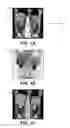 Fig. 02 - Composite images for medical procedures