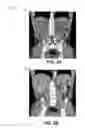 Fig. 03 - Composite images for medical procedures