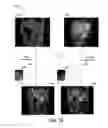 Fig. 13 - Composite images for medical procedures