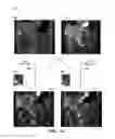 Fig. 14 - Composite images for medical procedures