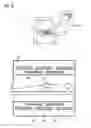 Fig. 08 - Method and computer system for automatic vectorization of a vessel tree