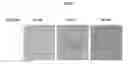 Fig. 06 - Mesenchymal stem cells and bone-forming cells