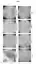 Fig. 07 - Mesenchymal stem cells and bone-forming cells