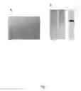 Fig. 02 - ERYTHROCYTE-BASED DELIVERY SYSTEM, METHOD OF PREPARATION AND USES THEREOF