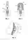 Fig. 02 - Soft tissue models and method of making for dental implant applications