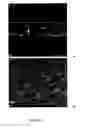 Fig. 02 - Membrane for cell expansion