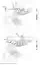 Fig. 08 - Method and apparatus for improving posture