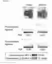 Fig. 200 - COMPOSITIONS, KITS, AND METHODS FOR IDENTIFICATION, ASSESSMENT, PREVENTION, AND THERAPY OF HEPATIC DISORDERS