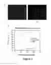 Fig. 04 - Platelet analysis