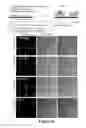 Fig. 07 - Platelet analysis