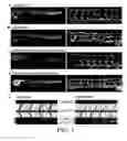 Fig. 02 - Compositions and methods for inhibiting vascular permeability
