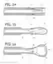 Fig. 06 - Device and method for controlling injection of liquid embolic composition