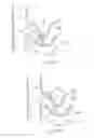 Fig. 33 - Catheter apparatuses, systems, and methods for renal neuromodulation