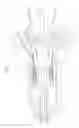 Fig. 07 - Irrigated catheter with internal position sensor