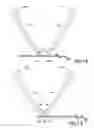Fig. 07 - Bone plate bender system