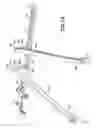 Fig. 08 - Bone plate bender system