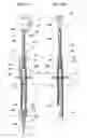 Fig. 02 - Intraocular lens insertion device