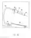 Fig. 07 - Insertion mode phacoemulsification employing powered IOL delivery