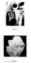 Fig. 02 - Method and apparatus for grafting of skin tissue