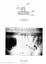 Fig. 04 - Method and apparatus for grafting of skin tissue