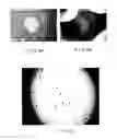 Fig. 06 - Method and apparatus for grafting of skin tissue