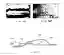 Fig. 07 - Method and apparatus for grafting of skin tissue