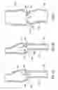 Fig. 02 - Percutaneous methods for apparatus for creating native tissue venous valves