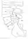 Fig. 01 - Method and apparatus for spinal stabilization