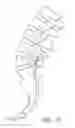 Fig. 02 - Method and apparatus for spinal stabilization