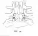 Fig. 06 - Method and apparatus for spinal stabilization