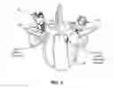 Fig. 04 - BONE FIXATION DEVICE AND METHOD OF VALIDATING ITS PROPER PLACEMENT
