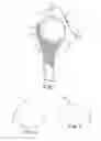 Fig. 02 - Intra-articular joint replacement and method