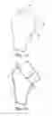 Fig. 07 - Intra-articular joint replacement and method