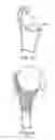 Fig. 08 - Intra-articular joint replacement and method