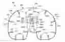 Fig. 01 - Expandable arthroplasty plates