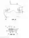 Fig. 03 - Expandable arthroplasty plates