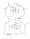 Fig. 06 - Expandable arthroplasty plates