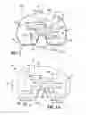 Fig. 07 - Expandable arthroplasty plates