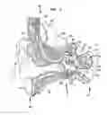 Fig. 02 - IMPLANTABLE HEARING PROSTHESIS