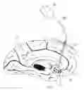 Fig. 01 - MULTIPLE ELECTRODE LEAD AND A SYSTEM FOR DEEP ELECTRICAL NEUROSTIMULATION INCLUDING SUCH A LEAD