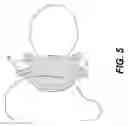 Fig. 06 - Cochlear implant component having a unitary faceplate