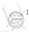 Fig. 06 - HOT TIP VEIN THERAPY DEVICE