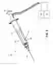 Fig. 07 - HOT TIP VEIN THERAPY DEVICE