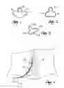 Fig. 02 - Spinal Cord Stimulator Lead Anchor