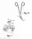 Fig. 04 - Spinal Cord Stimulator Lead Anchor
